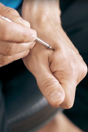 Acupressure on the hand with AkuPen from Simply Live Better