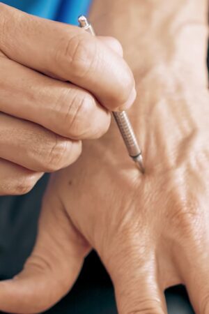 Acupressure on the hand with AkuPen from Simply Live Better