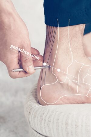 Acupressure on the heel with AkuPen from Simply Live Better