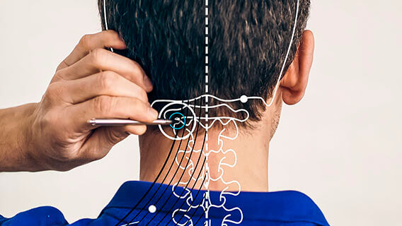 Head with graphic, position of acupuncture point BL 10 is shown with AkuPen
