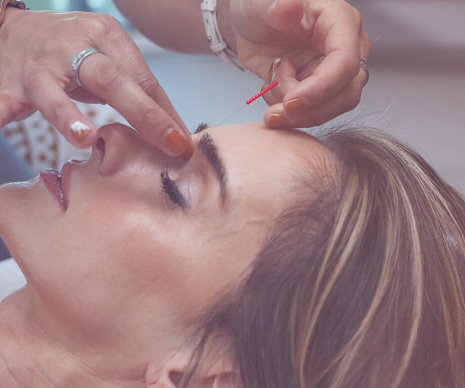 Woman gets an acupuncture needle stuck in her forehead