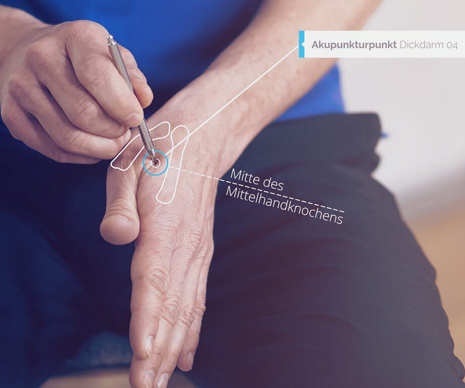 El punto de acupuntura DI 04 se presiona con el AkuPen de Einfach besser leben, un gráfico muestra el punto