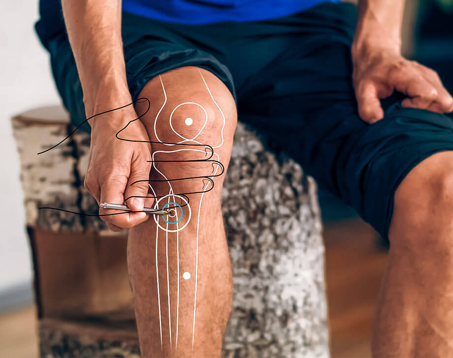 Graphic representation of the acupuncture point St 36