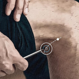 Posizione del punto di agopuntura Bl 40 Graphic