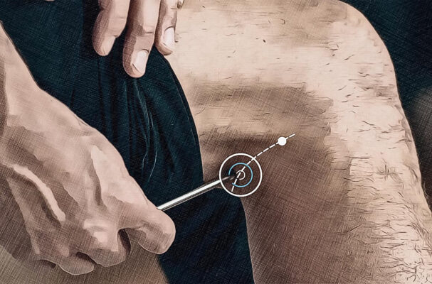 Location acupuncture point Bl 40 graphic