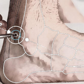 Posizione del punto di agopuntura Bl 60 Graphic