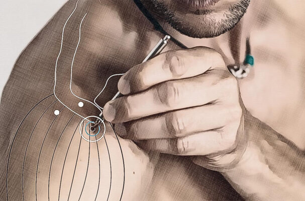 Location acupuncture point Di 15 Graphic