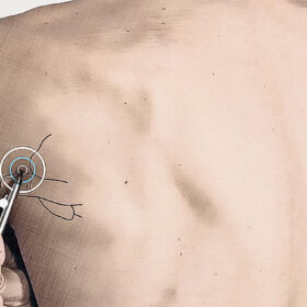 Emplacement du point d'acupuncture IG 09 Graphique