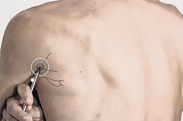 Location acupuncture point SI 09 Graphic