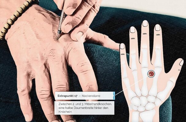 Location acupuncture point Ex 17 graphic