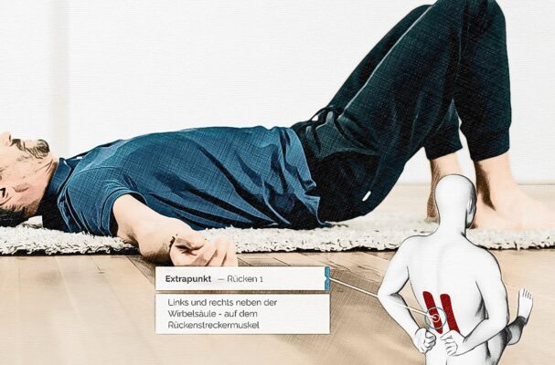 Location acupuncture point Ex R1 graphic