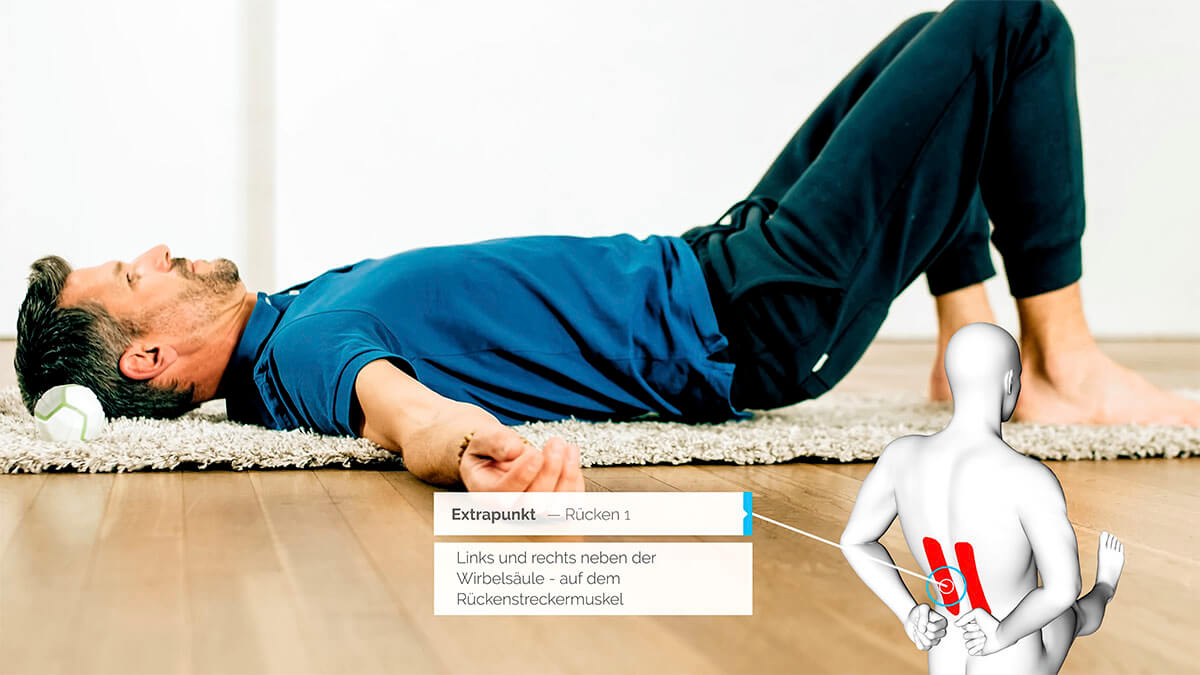 Location of acupuncture point Ex R1 Video