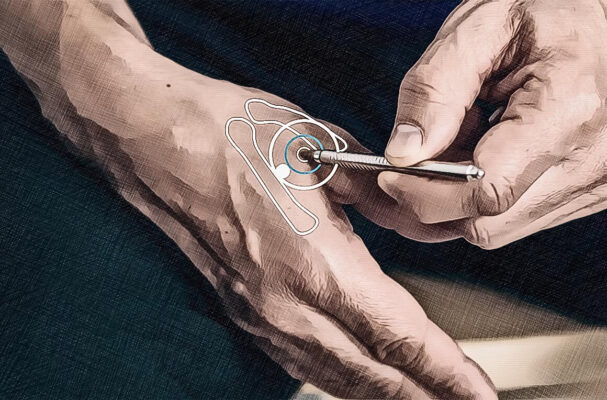 Location acupuncture point extra point Fanhoujue Location acupuncture point extra point Fanhoujue graphic