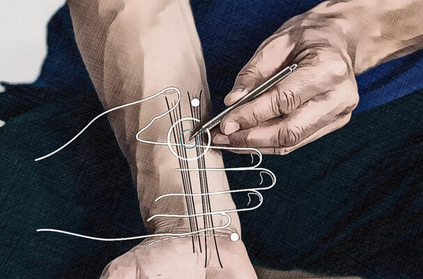 Location acupuncture point Pc 05 graphic