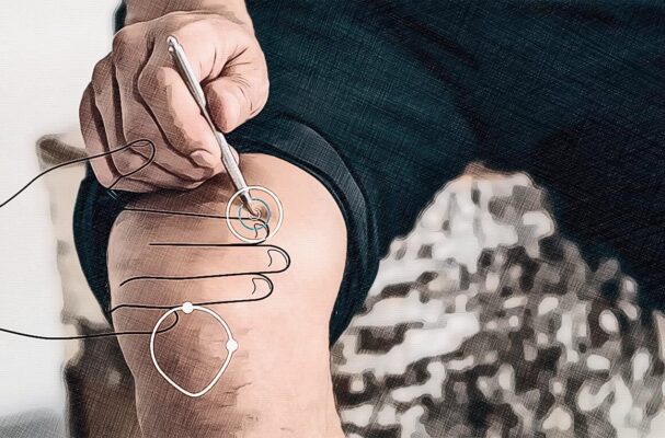 Posizione del punto di agopuntura MP 10 Posizione del punto di agopuntura MP 10 Grafico