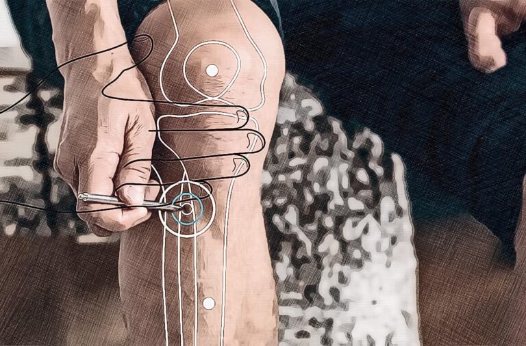 Location acupuncture point St 36 graphic