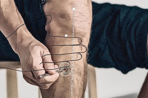 Location acupuncture point St 36 graphic