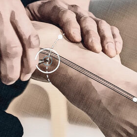 Localización del punto de acupuntura Ma 41 Gráfico