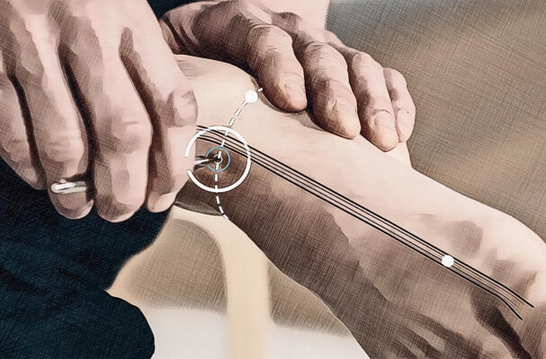 Location acupuncture point St 41 graphic