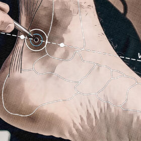 Lage Akupunkturpunkt Ni 03 Grafik