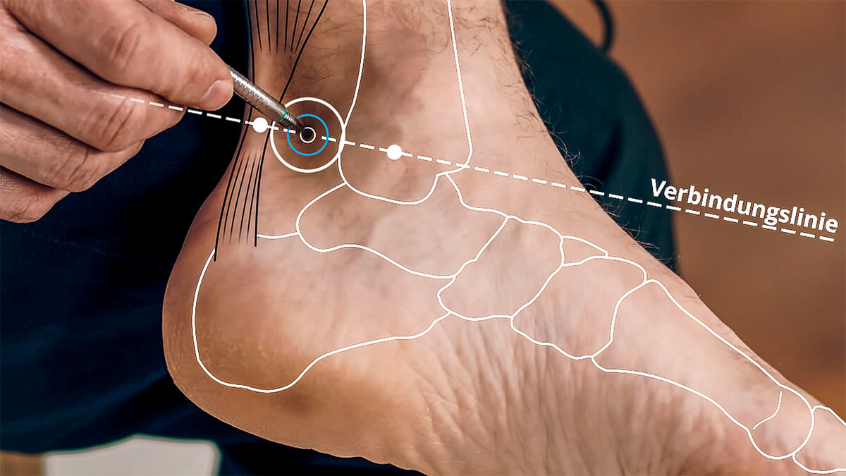 Location of acupuncture point Ni 03 Video