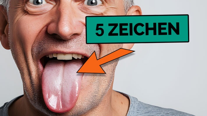 Tongue diagnosis according to TCM